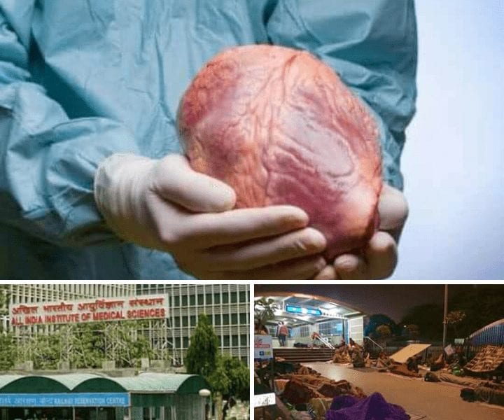 20180609 180323 720x600 2