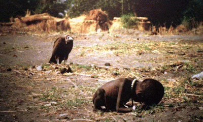 Vulture and the malnutritioned child