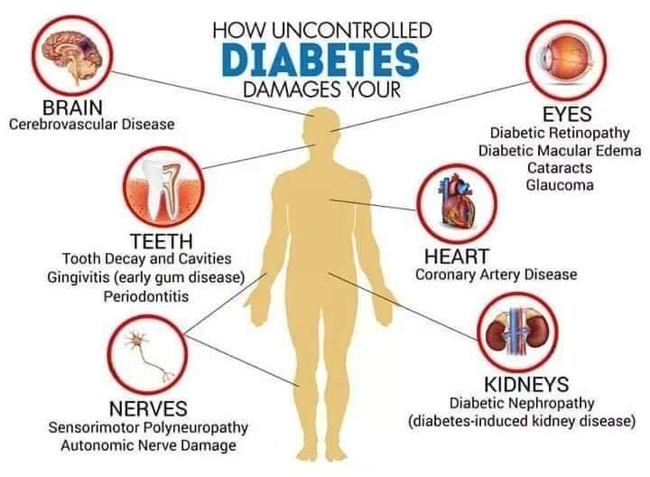 Uncontrolled Diabetes and its effects on the body.