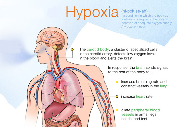 How Happy Hypoxia impacts body and brain?