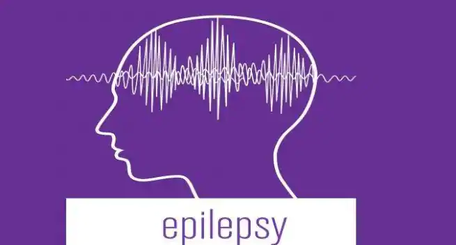 Epilepsy 655x353 1