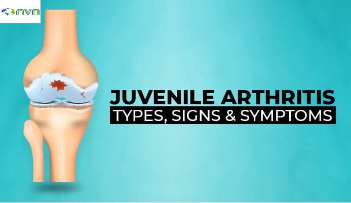 Juvenile Arthritis 5