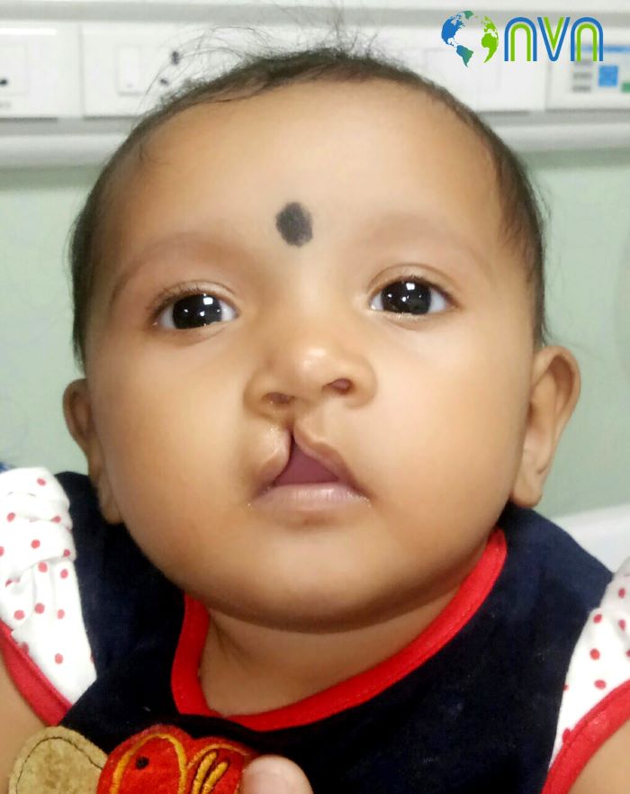 Saakshi Before the Surgery