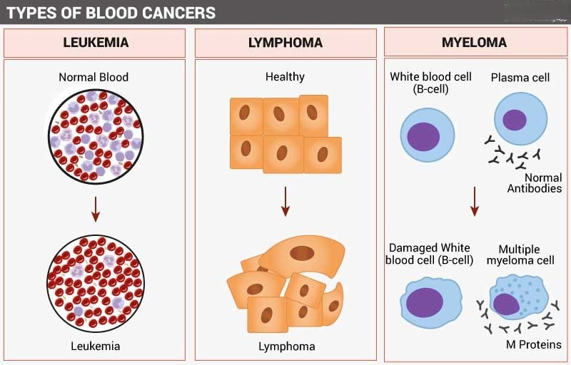 Types of Blood Cancers