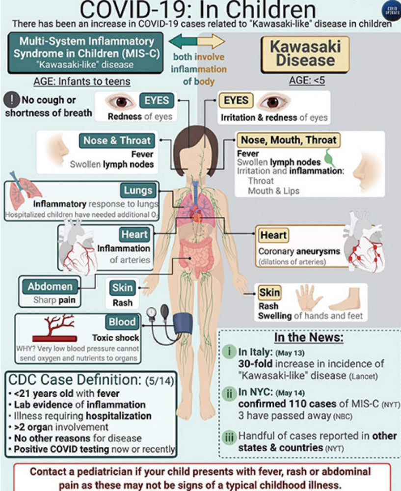 Covid - 19 in Children