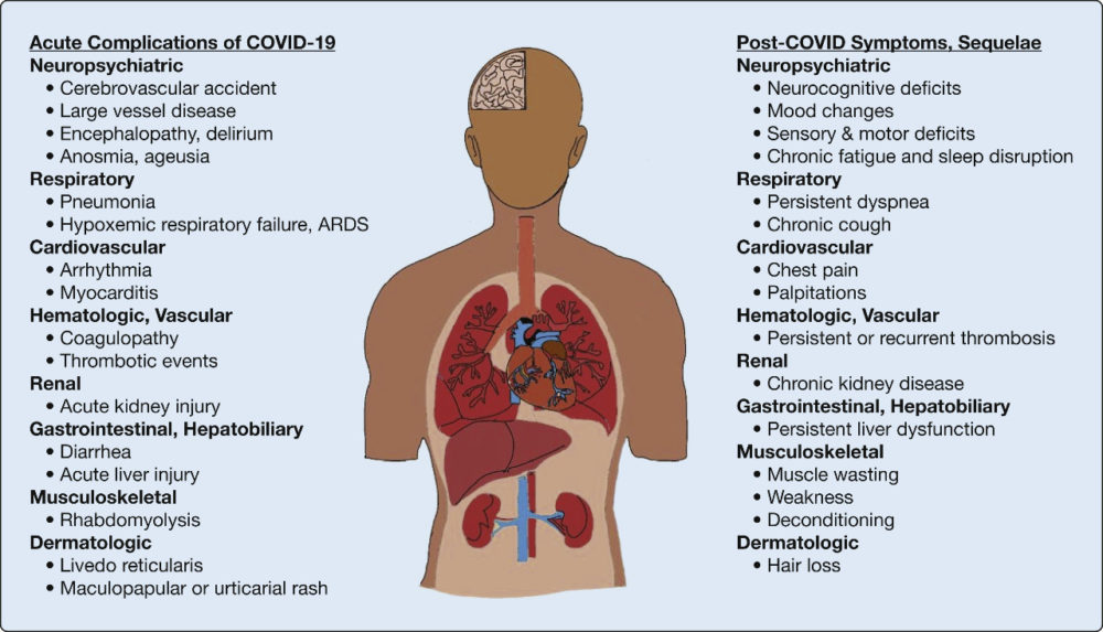 Acute Complications of Covid-19