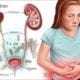 a medical illustration of the kidneys ureters bladder and urethra with E. coli in the background and a young girl holding her belly and looking distressed illustrating UTIs in children original