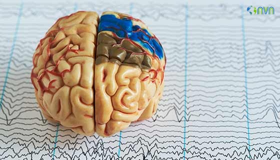 Neurological screening Test