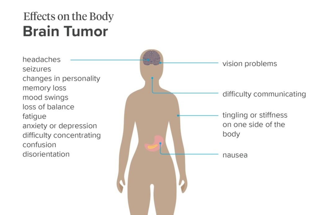 Brain tumor effects on the body
