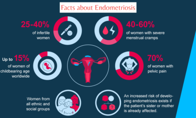 Endometriosis leading cause of Infertility in Women due to Delayed Diagnosis