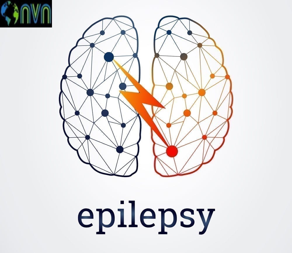 epileptic patient