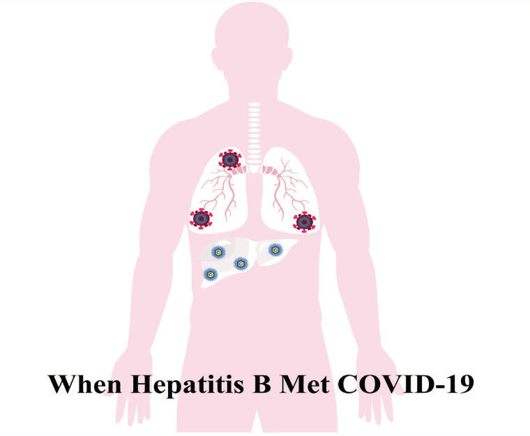 Hepatitis B and Covid 19