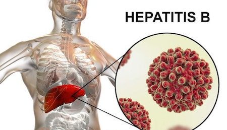 Hepatitis can't wait- World Hepatitis Day 2021