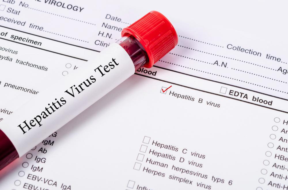 Covid-19 and Hepatitis - Important Information by Doctors