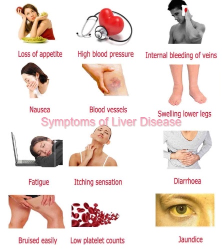 liver disease symptoms