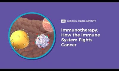 Development Of Immunotherapy In Cancer Treatments