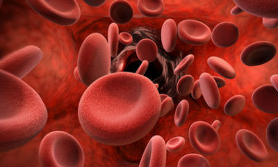 Thalassemia - 3 Common Myths and Reality