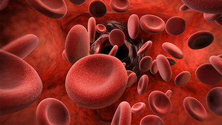 Thalassemia - 3 Common Myths and Reality