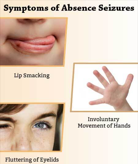 symptoms of absence seizuress 1