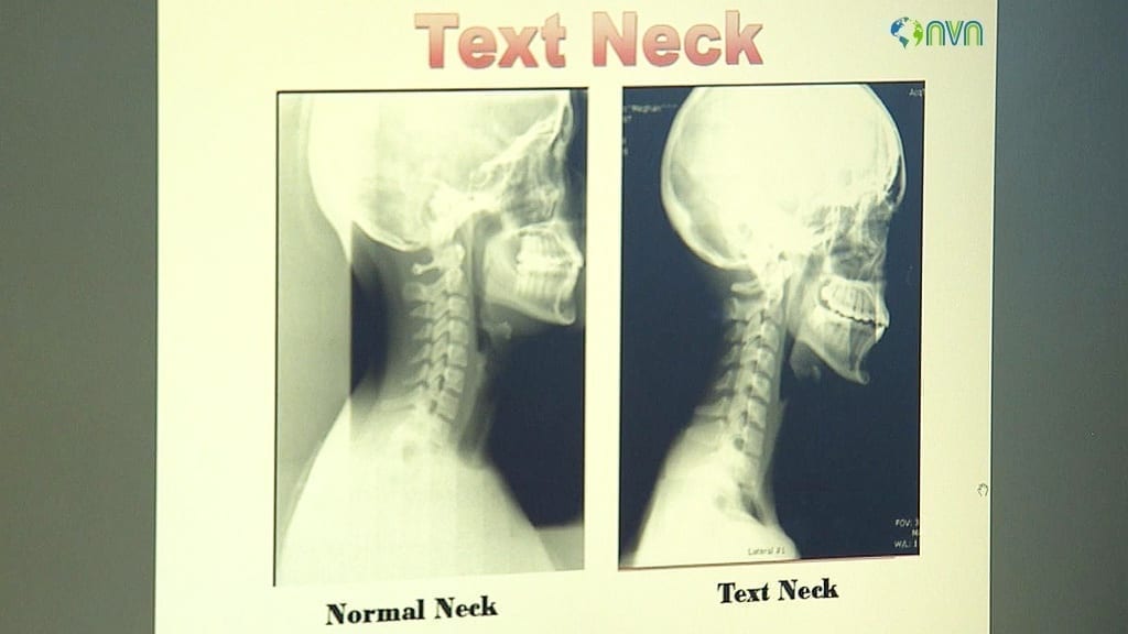 Text Neck