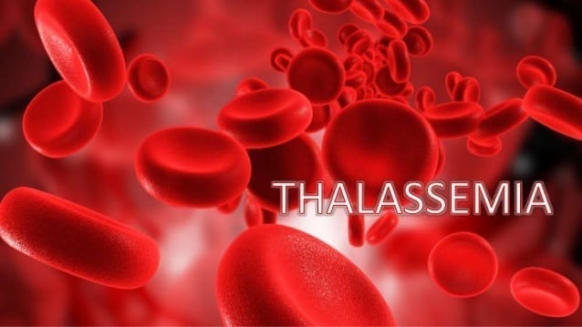 thalassemia 1 638