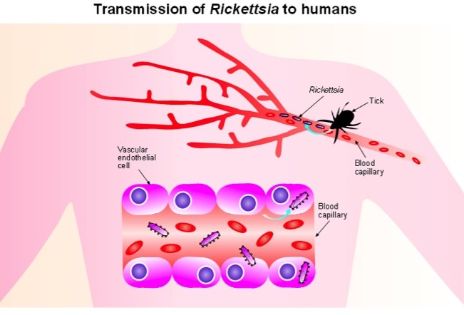 Transmission of Rickettsia to humans 
